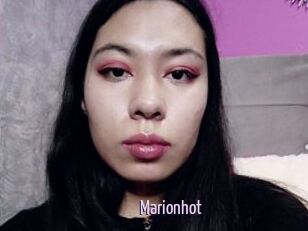 Marionhot Anal Dilatation